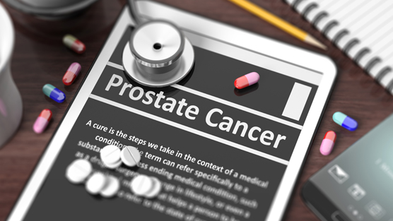 Prostate-Cancer-Treatment-Options
