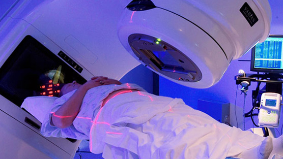 What Is Intensity Modulated Radiation Therapy (IMRT)?