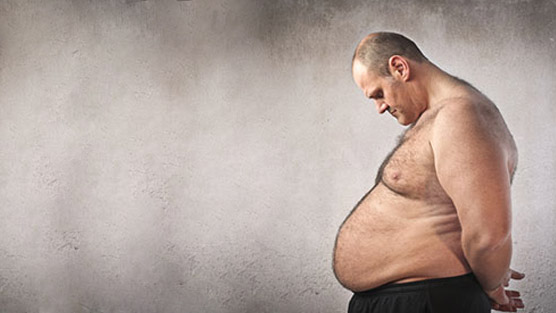 Obesity & Aggressive Prostate Cancer In White Men - Dr. David Samadi Investigates the Connection