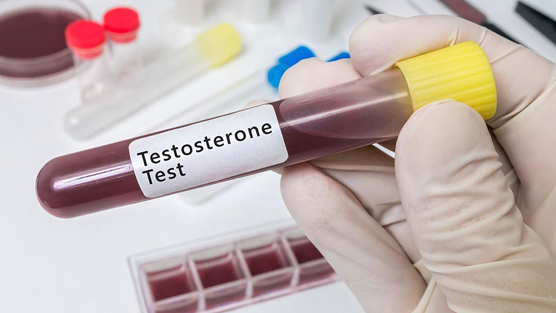 Clinical Testosterone Treatment Study Shows Unexpected Results In Prostate Cancer Treatment